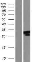 CCDC149 Protein (Over-Expression Lysate Myc-DDK (Flag))