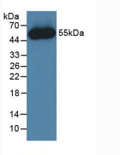 Human FGF1 / Acidic FGF Protein (Recombinant His-GST, N-terminus)