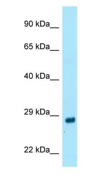 RAB4A / RAB4 Antibody (C-Terminus)