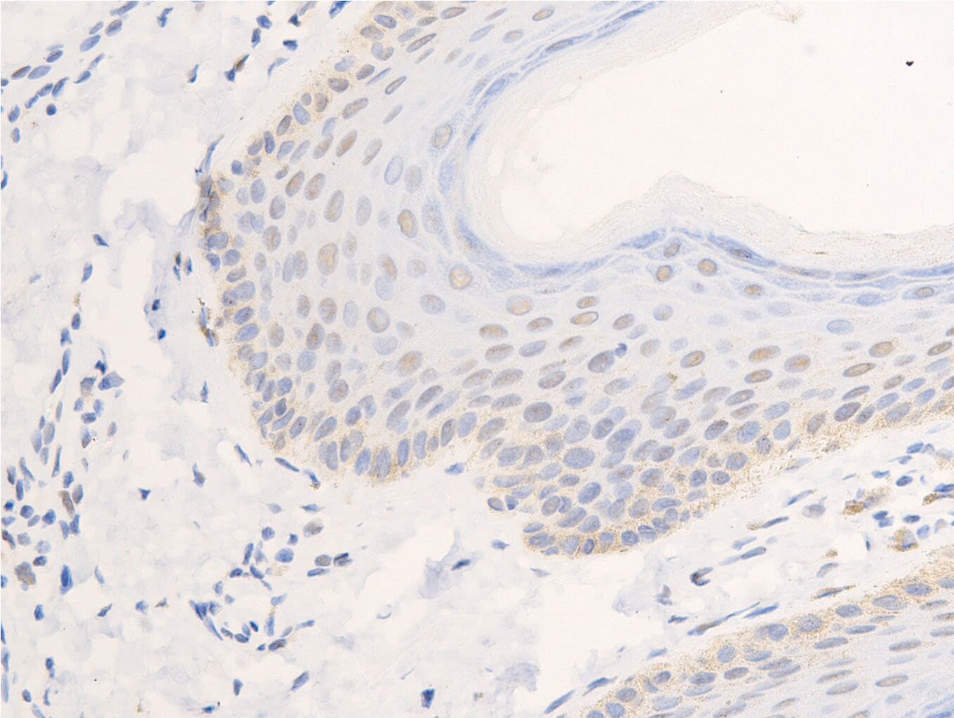 EGFR Antibody (phospho-Ser1026)