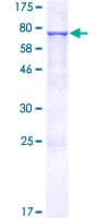 Human IOP1 / NARFL Protein (Recombinant GST)