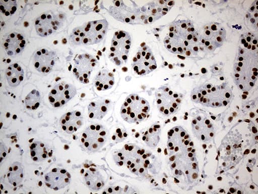HNRNPH1 / hnRNP H Antibody (clone OTI2E8)