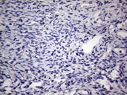 AGR2 Antibody (aa21-175, clone OTI2D11)
