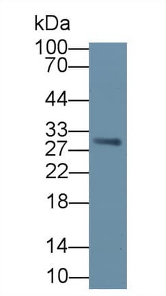 VTCN1 / B7-H4 Antibody (aa34-147)