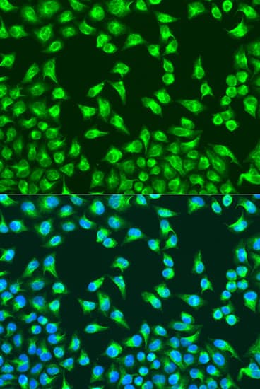 Polyclonal Rabbit anti-Mouse MT-CO2 Antibody (IF, WB)
