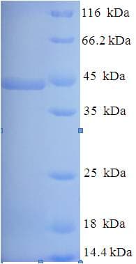 Pseudomonas aeruginosa Lysyl endopeptidase Protein (Recombinant His-SUMO)