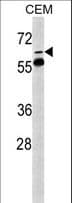FKBP10 / FKBP65 Antibody (aa57-87)