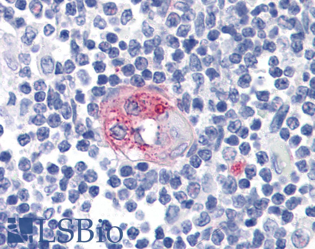 PathPlus™ FCER2 / CD23 Antibody (clone EBVCS2)