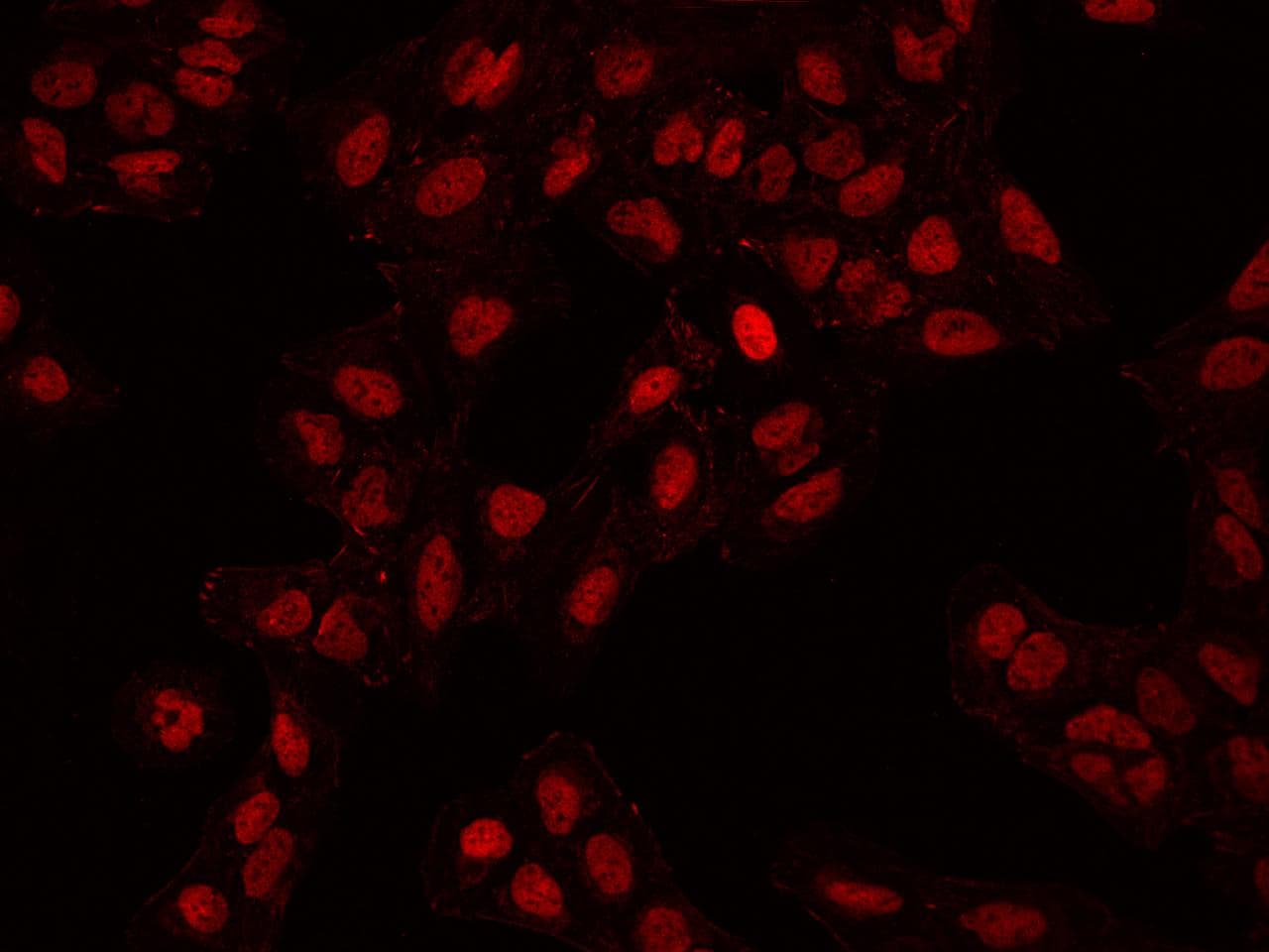 Polyclonal Rabbit anti-Human ADNP Antibody (IF, WB)
