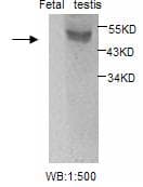 ESR2 / ER Beta Antibody
