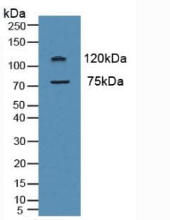MPO / Myeloperoxidase Antibody (aa134-263)