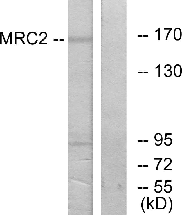 MRC2 / Endo180 Antibody (aa121-170)
