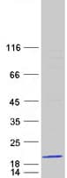 Human RPS14 / Ribosomal Protein S14 (Recombinant Myc-DDK (Flag))