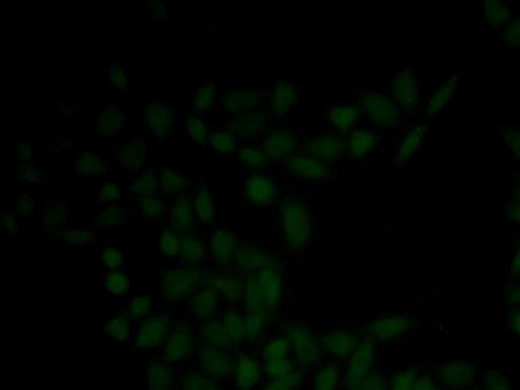 Polyclonal Rabbit anti-Human KRT5 / CK5 / Cytokeratin 5 Antibody (IHC, IF, WB)