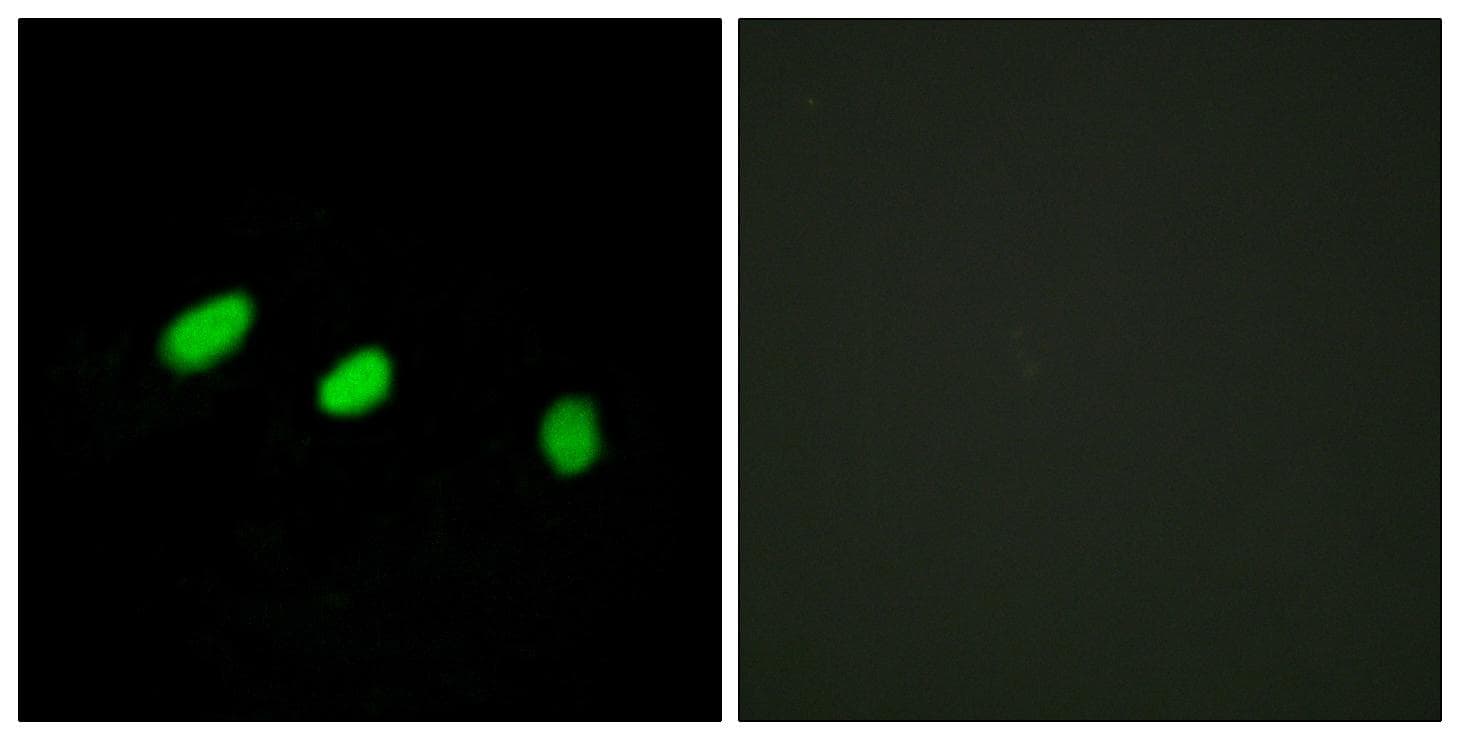 Polyclonal Rabbit anti-Human TRA2A Antibody (IHC, IF, WB)