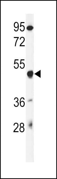 Polyclonal Rabbit anti-Human GSDMA Antibody (aa66-94, IHC, WB)