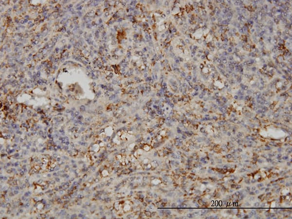 Monoclonal Mouse anti-Human SNAP23 / SNAP-23 Antibody (clone 2F5-3D4, IHC, WB)