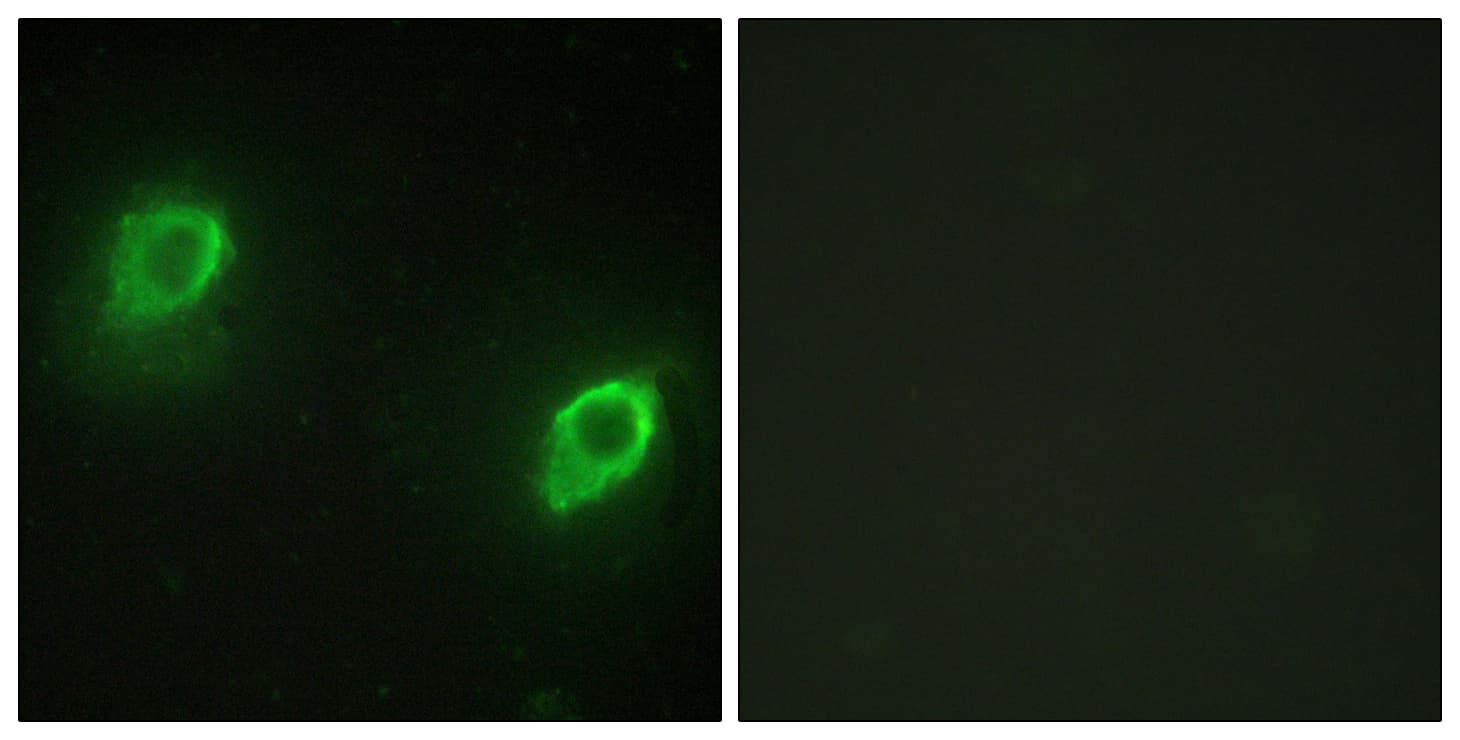 AKAP5 / AKAP79 Antibody (aa1-50)
