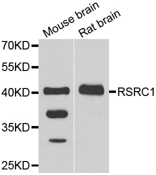 Polyclonal Rabbit anti-Human RSRC1 Antibody (IHC, IF, WB)