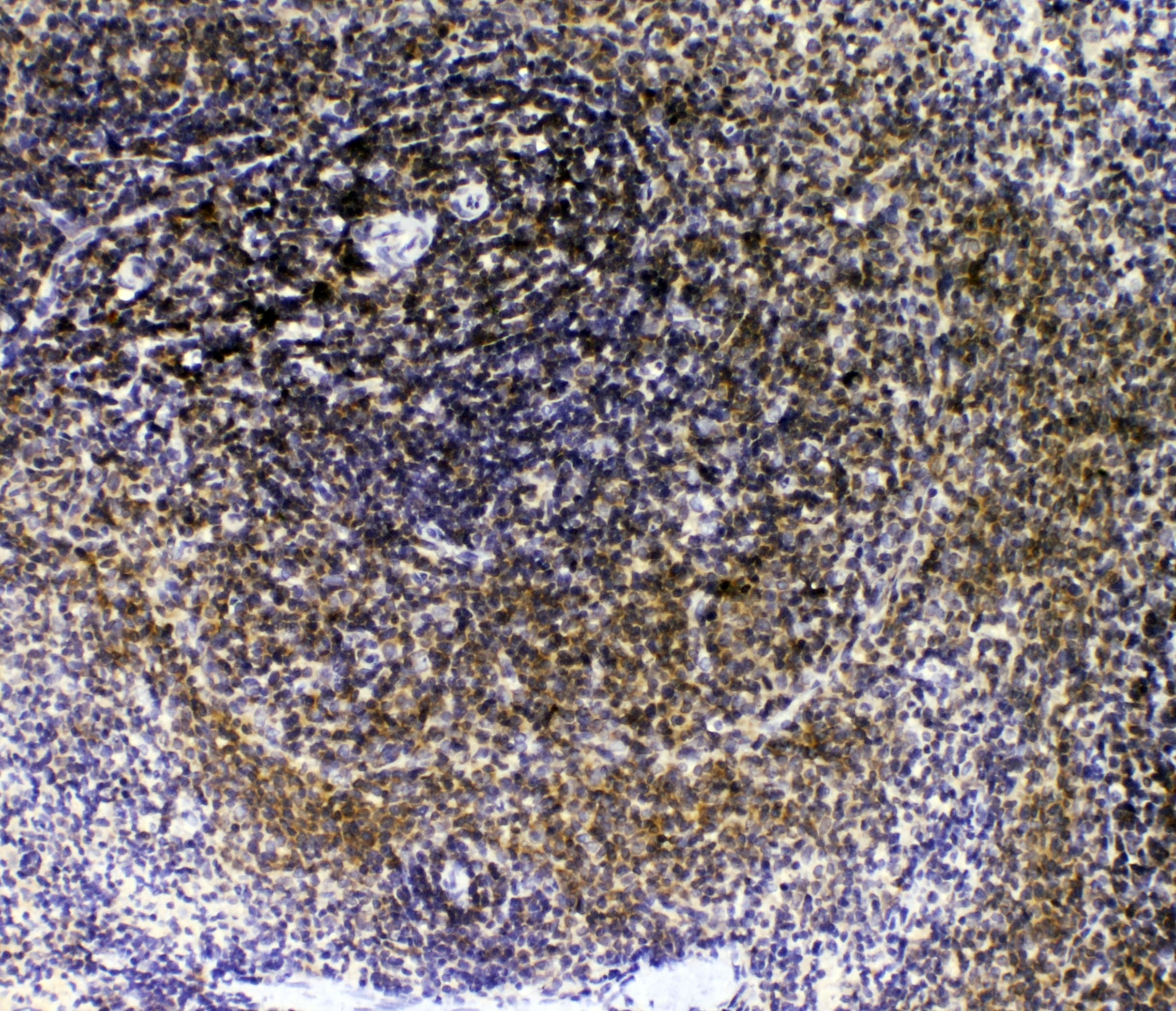 Polyclonal Rabbit anti-Mouse IL16 Antibody (WB)