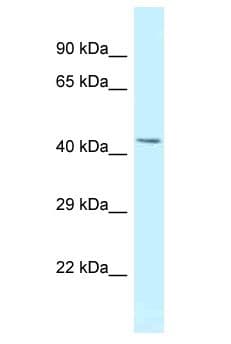 Polyclonal Rabbit anti-Rat MBNL2 Antibody (aa51-100, WB)