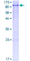 Human PLOD2 Protein (Recombinant GST)