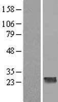 CCDC70 Protein (Over-Expression Lysate Myc-DDK (Flag))