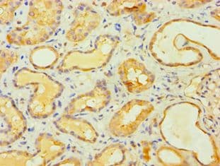 Polyclonal Rabbit anti-Human MCPH1 Antibody (aa536-835, IHC)