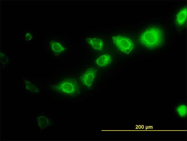 CAPNS1 / CAPN4 Antibody (clone 3C4)