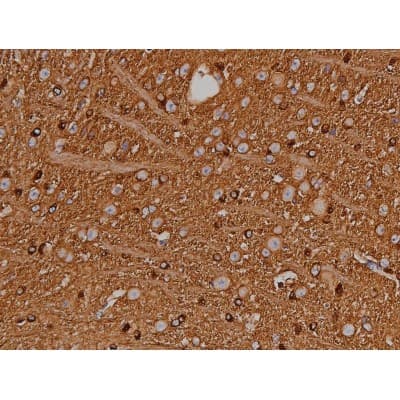 MAPT / Tau Antibody (phospho-Ser404)