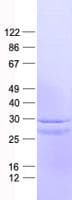Human SH3BGR Protein (Recombinant His, N-Terminal)