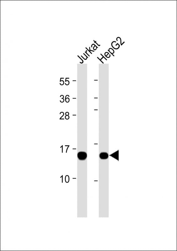 RBX1 / ROC1 Antibody (clone 1859CT866.7.47)