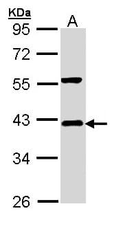 NFKBIA / IKB Alpha / IKBA Antibody (aa1-317)