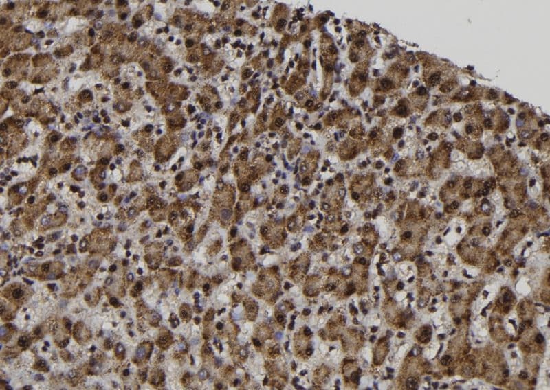 Polyclonal Rabbit anti-Human MAGE12 / MAGEA12 Antibody (IHC, WB)