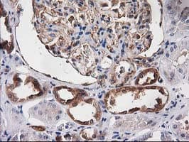 DSTN / Destrin Antibody (clone OTI2F7)