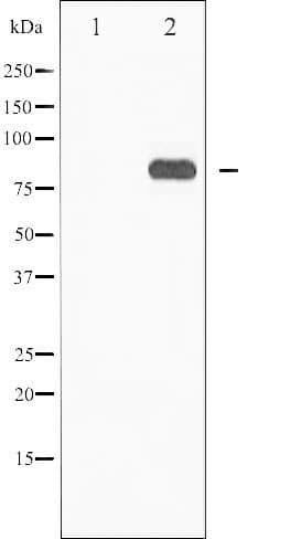 STAT5A Antibody (phospho-Ser725,pSer730)