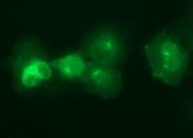 IL6R / IL6 Receptor Antibody (clone OTI2F4)