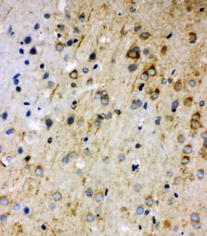 RAB5A / RAB5 Antibody (aa138-155)