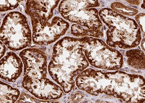 GRN / Granulin Antibody