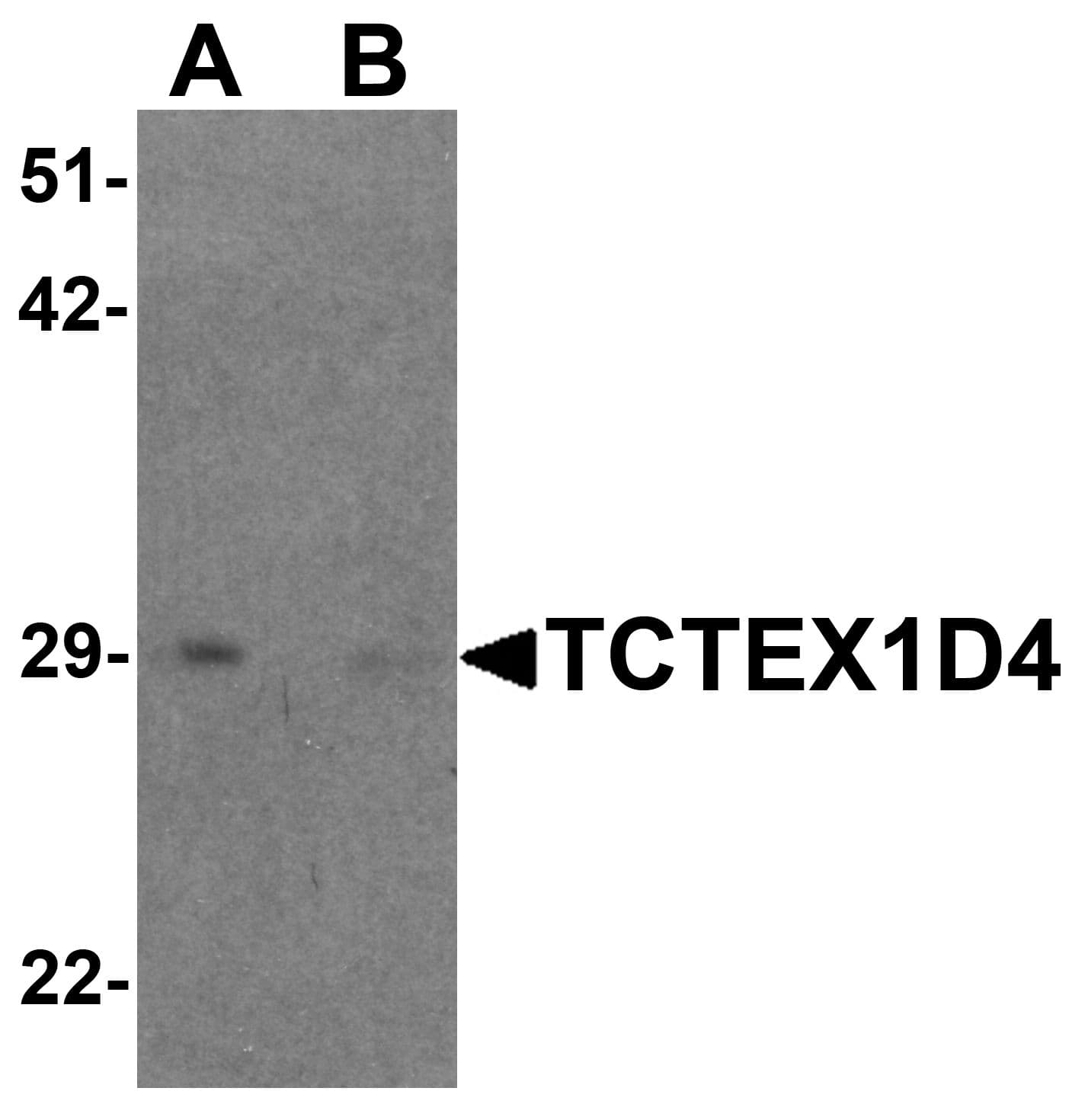 IHC-plus™ TCTEX1D4 Antibody