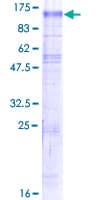 Human SLC9A6 Protein (Recombinant GST)