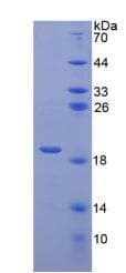 Mouse ANXA2 / Annexin A2 Protein (Recombinant His, N-Terminal)