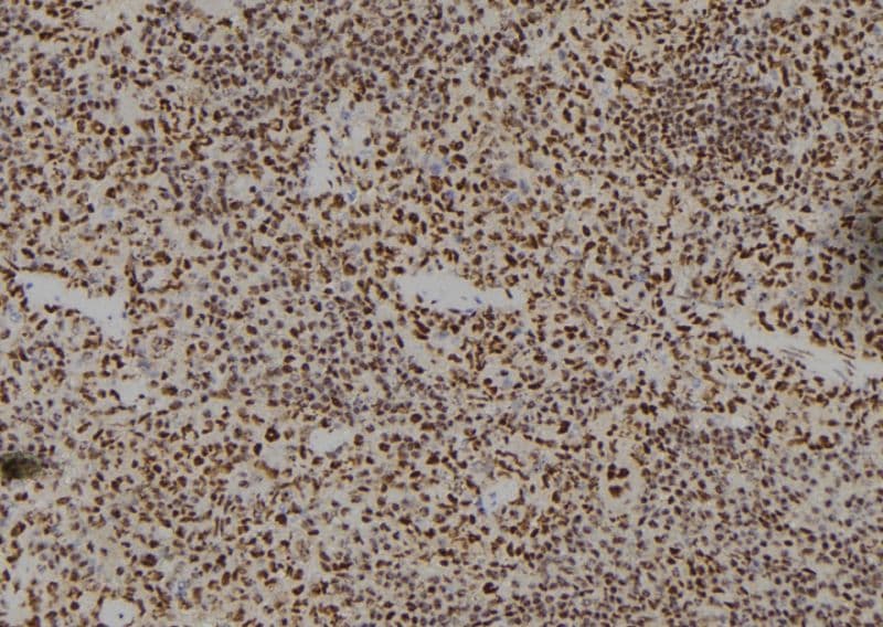 HOXA11 Antibody