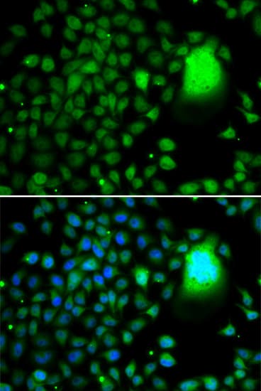 TAF5 Antibody