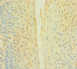 CYBB / NOX2 / gp91phox Antibody (aa283-570)