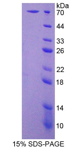 Human WNT16 Protein (Recombinant His-GST)