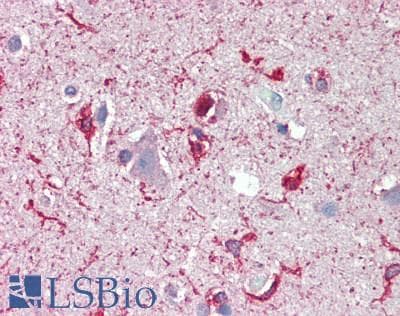IHC-plus™ SCN2B Antibody