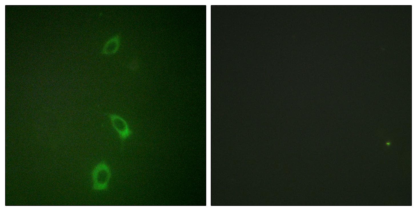 KCNJ1 / ROMK Antibody (Ab-44/25)