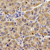 UQCR10 / UCRC Antibody