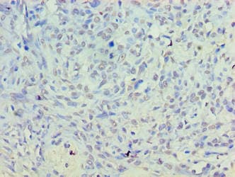 PLD5 / Phospholipase D5 Antibody